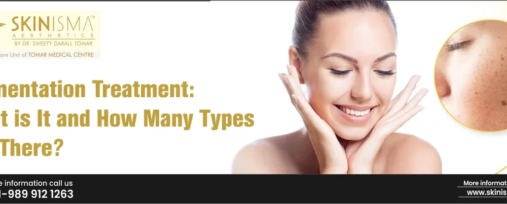 Pigmentation Treatment: What is It and How Many Types Are There?