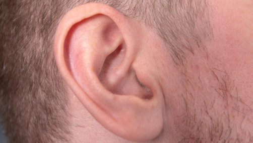 Ear Lobe Repair